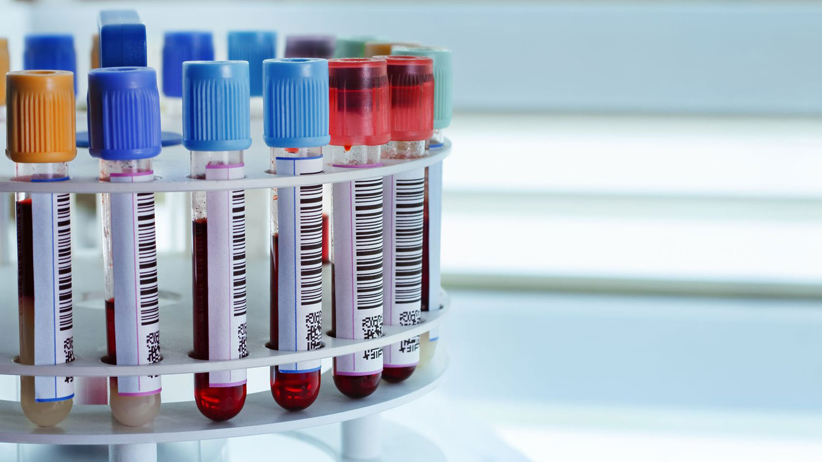 Blood Analysis Melbourne
